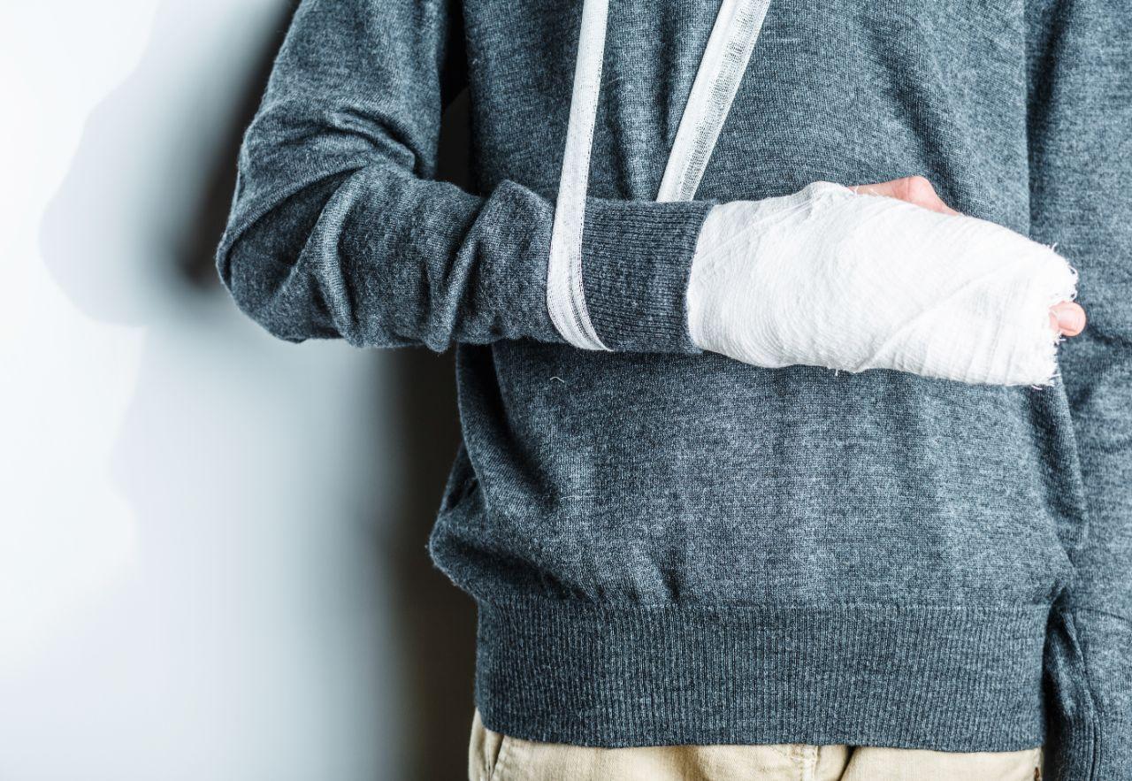 Mavie Work - Sehnenscheidenentzündung 7 - Blog Ein Gips dient zur Ruhigstellung des Gelenks.  Shutterstock.com / Alexxndr