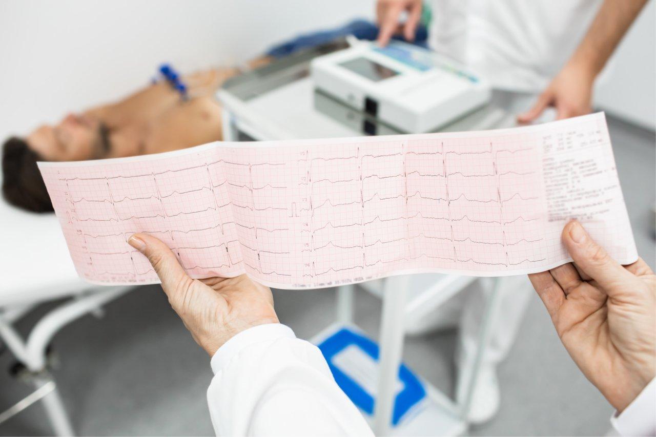 Mavie Work - Herzinfarkt 4 - Blog Ein EKG kann Aufschluss über einen Herzinfarkt geben. / Peakstock