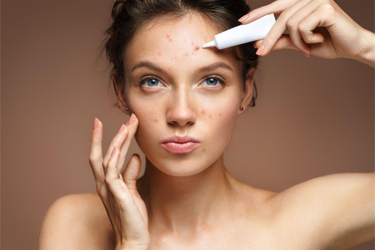 Mavie Work - Hautausschlag durch Stress 2 - Blog Bei einem Hautausschlag kann es zu Rötungen und Pickeln kommen. Shutterstock.com / Romariolen